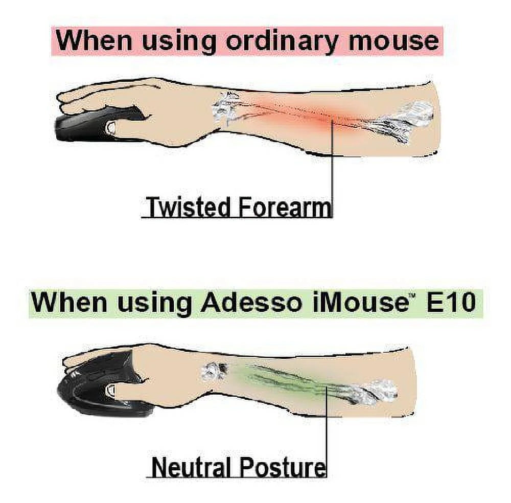 Ergo Mouse B888116